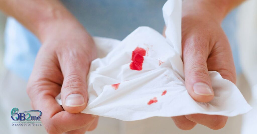 bleeding at 10 weeks pregnant